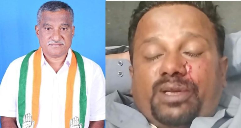 ತಾಲೂಕು ಪಂಚಾಯಿತಿ ಇಓ ಮೇಲೆ ಹಲ್ಲೆ ಆರೋಪ; ಬ್ಲಾಕ್ ಕಾಂಗ್ರೆಸ್ ಅಧ್ಯಕ್ಷನ ವಿರುದ್ಧ ಪ್ರಕರಣ