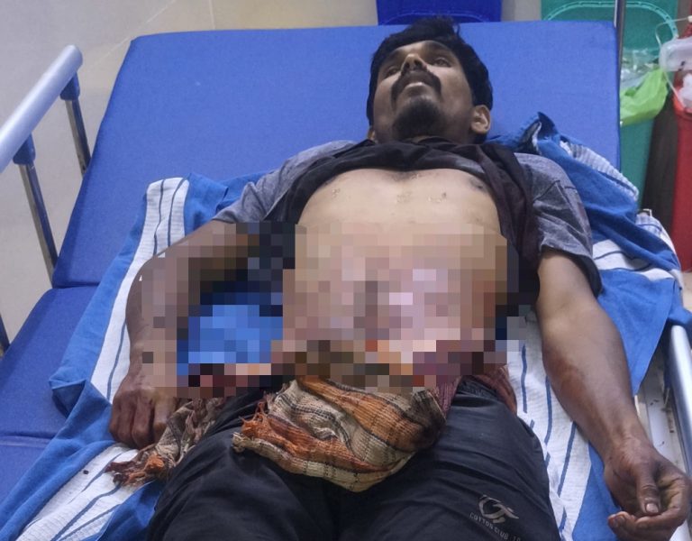 ಶಿಕಾರಿಗೆ ತೆರಳಿದ್ದ ವೇಳೆ ಆಕಸ್ಮಿಕ ಗುಂಡೇಟು — ಯುವಕ ಸಾವು